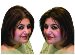 Women’s hair loss, hair thickening fibres before and after, cotton microfibres for thinning hair in women, solution for widening psrt hair loss.