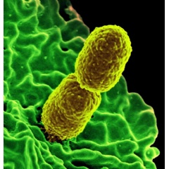 Infection Control Resources to Detect Klebsiella and Other Pathogens in Healthcare Environments