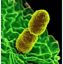Infection Control Resources to Detect Klebsiella and Other Pathogens in Healthcare Environments