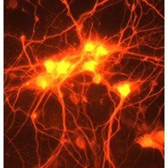Sprouting connections in the brain.  Adding GDF10 to neurons in a dish results in the formation of new connections between brain cells. This process may lead to recovery after stroke. Image courtesy of S. Thomas Carmichael, M.D., Ph.D.h