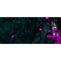 This image shows a costaining of T cells (cyan) expressing the chemokine CCL5 (yellow), which reside at a site of resolved virus infection (pink). © UNIGE
