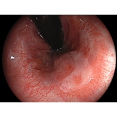 High Resolution Image with 170 degree field of view