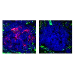 St. Jude Children’s Research Hospital scientists have discovered that the tumor suppressor protein PTEN also ensures that regulatory T cells function properly and helps maintain a balanced immune response.