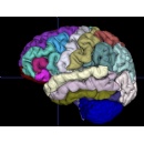 Prenuvo-Powered Study Published in Nature Journal Links Smoking to Brain Shrinkage
