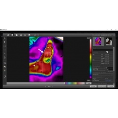 Technique involves use of non-invasive digital infrared imaging.
-Credit:  McGill-