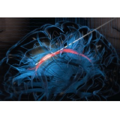 Illustration shows how an electrode was used to stimulate the cingulum bundle. Courtesy of American Society of Clinical Investigation.