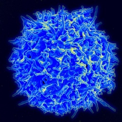 electron micrograph of a human T cell from the immune system of a healthy donor. In multiple sclerosis, certain kinds of T cells are involved in the immune system’s attack on the central nervous system. NIAID