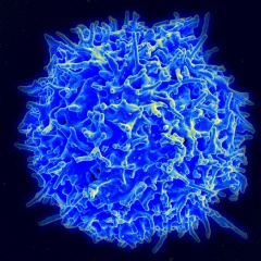 electron micrograph of a human T cell from the immune system of a healthy donor. In multiple sclerosis, certain kinds of T cells are involved in the immune system’s attack on the central nervous system. NIAID