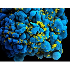 Scanning electromicrograph of an HIV-infected T cell. NIAID
