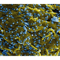 Colorized scanning electron micrograph of Marburg virus particles (blue) both budding and attached to the surface of infected VERO E6 cells (yellow). Image captured and color-enhanced at the NIAID Integrated Research Facility in Fort Detrick, Marylan