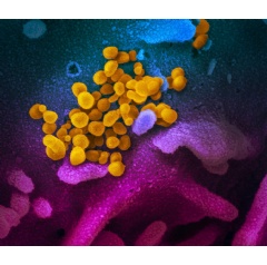 This scanning electron microscope image shows SARS-CoV-2 (yellow)—also known as 2019-nCoV, the virus that causes COVID-19—isolated from a patient in the U.S., emerging from the surface of cells (blue/pink) cultured in the lab. NIAID-RML