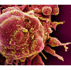 Colorized scanning electron micrograph of an apoptotic cell (red) heavily infected with SARS-COV-2 virus particles (yellow), isolated from a patient sample. Image captured at the NIAID Integrated Research Facility (IRF) in Fort Detrick, MD. NIAID