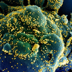 Colorized scanning electron micrograph of an apoptotic cell (green) infected with SARS-COV-2 virus particles (orange), isolated from a patient sample. Image captured at the NIAID Integrated Research Facility (IRF) in Fort Detrick, Maryland. NIAID