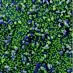 Colorized scanning electron micrograph of a VERO E6 cell (blue) heavily infected with SARS-COV-2 virus particles (green) isolated from a patient sample. Image captured & color-enhanced at the NIAID Integrated Research Facility(complete caption below)