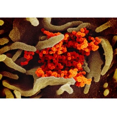 This scanning electron microscope image shows SARS-CoV-2 (orange)—also known as 2019-nCoV, the virus that causes COVID-19—isolated from a patient in the U.S., emerging from the surface of cells (green) cultured in the lab (See Complete Caption below)