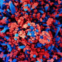 Colorized scanning electron micrograph of a cell (blue) heavily infected with SARS-CoV-2 virus particles (red), isolated from a patient sample. NIAID