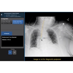 Endotracheal Tube Placement is Measured with AI-Enhabled Critical Care Suite 2.0