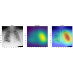 Generated heat maps appropriately highlighted abnormalities in the lung fields in those images accurately labeled as COVID-19 positive.