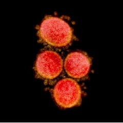 Transmission electron micrograph of SARS-CoV-2 virus particles, isolated from a patient. Image captured and color-enhanced at the NIAID Integrated Research Facility (IRF) in Fort Detrick, Maryland. NIAID