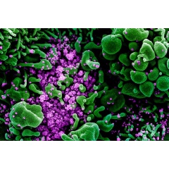 Colorized scanning electron micrograph of an apoptotic cell (green) heavily infected with SARS-COV-2 virus particles (purple), isolated from a patient sample. Image by National Institute of Allergy and Infectious Diseases