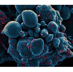 Colorized scanning electron micrograph of an apoptotic cell (blue) infected with SARS-COV-2 virus particles (red), isolated from a patient sample.NIAID