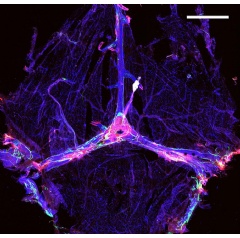 Study of mouse brain shows the meningeal lymphatics system (purple and pink) could help reduce amyloid. Sandro Da Mesquita, Ph.D.