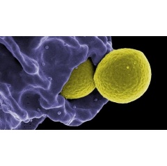 Scanning electron micrograph of methicillin-resistant Staphylococcus aureus (MRSA) bacteria being engulfed by an immune cell known as a neutrophil. Credit: NIAID, NIH (See complete caption below)