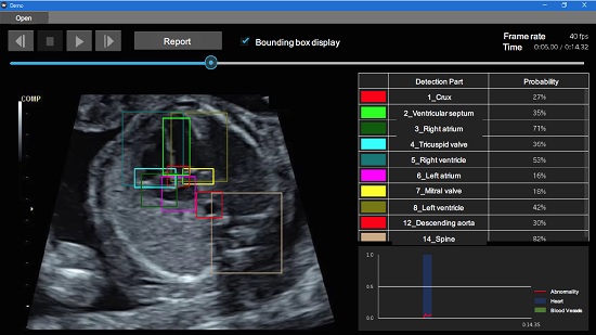 AI Used To Detect Fetal Heart Problems WebWire