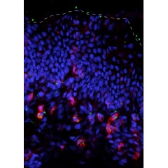Bacteria (green dots) along the skin surface (dashed white line) being taken up by skin immune cells (red). Credit: Scharschmidt Lab/UCSF