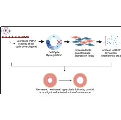 A new study shows that when fragile-X related protein-1 (FXR1) is absent, vascular smooth muscle cells (VSMC) proliferate more slowly, become senescent, and scar tissue (neointima) development is reduced. (see complete caption below)