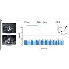 Caption: Genome-wide association studies of hair whorl direction identified four significant signals. (a) Patterns of whorl direction. (b) Manhattan plot and quantile-quantile plot (see complete caption below)