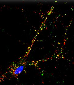 Synapses – sites of intercellular communications –are revealed in a mature iPSC cortex neuron derived from a patient in the study. Immune-based staining shows synapse markers (red, green) and the cell’s nucleus (blue). Source: Hongjun Song, Ph.D. JHU