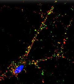 Synapses  sites of intercellular communications are revealed in a mature iPSC cortex neuron derived from a patient in the study. Immune-based staining shows synapse markers (red, green) and the cells nucleus (blue). Source: Hongjun Song, Ph.D. JHU