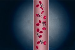 Years before they show any other signs of disease, pancreatic cancer patients have very high levels of certain amino acids in their bloodstream, according to a new study.
Christine Daniloff/MIT
