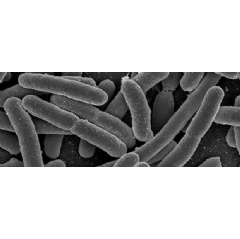 Scientists have engineered the bacterium E. coli (pictured here) so its life depends on an artificial chemical available only in the laboratory. This strategy could prevent leaks of GMOs from the lab into natural ecosystems. Photo courtesy of the NIH
