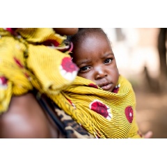 A child carried by a mother attending a clinic where basic health care services are provided to infants and children in the Chibolele area, Ndola, Copperbelt Province, Zambia, 23 November 2016.