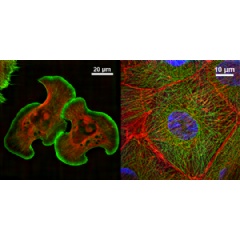 Super-resolution images acquired using the N-SIM S  -  

Left: Lamellipodia of NG108 cell*1
Right: LLC-PK1*2