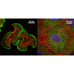 Super-resolution images acquired using the N-SIM S  -  

Left: Lamellipodia of NG108 cell*1
Right: LLC-PK1*2