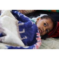 UNICEF/UN0184899/Mepham
Rihanna Sam (4 years old) is from Mendi and is suffereing an infection in her femur after her leg was broken during the earthquake.