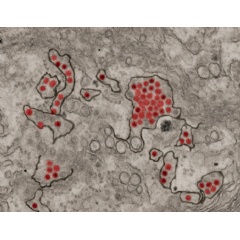 Zika virus particles (red) shown in African green monkey kidney cells. NIAID