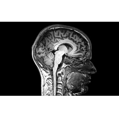 The awards contribute to NSF’s investments in support of Understanding the Brain and the BRAIN Initiative, a coordinated research effort that seeks to accelerate the development of new neurotechnologies. Credit: deradrian via Flickr Creative Commons