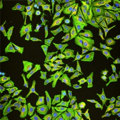 Fluorescence images of the actin, nuclei and mitochondria of HeLa cells are simultaneously acquired and then overlaid.