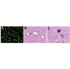 In (A), brain tissue from a twelve-month–old rTg-DI rat (B) and occluded microvessels (C) in the thalamic region. Scale bars = 50 µm.