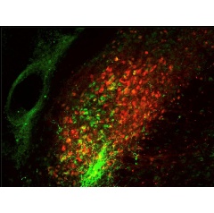 Two different groups of parabrachial neurons, one expressing calcitonin gene-related peptide (green) and the other expressing substance P (red).Arnab Barik, Chesler Laboratory, NCCIH