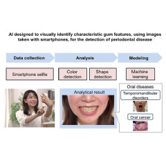 Overview of Periodontal Disease Detection AI