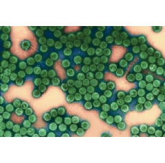 Papillomavirus particles in electron microscopy. Credit:  Institut Pasteur/Odile Croissant.
