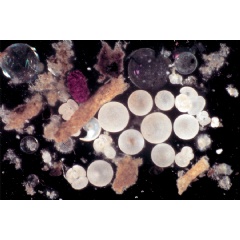 One of the first photographs of a sediment trap sample shows pellets, aggregates, and shells that make up sinking marine snow.
Credits:
Credit:  Woods Hole Oceanographic Institution