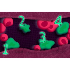 MIT engineers developed a technique that, for the first time, allows them to count tumor cells and measure the generation rate and half-life of circulating tumor cells (CTCs).
Credits:
Image: Jose-Luis Olivares, MIT