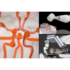 MIT engineers developed a telerobotic system to help surgeons remotely treat patients experiencing stroke or aneurysm.
Credits:
Credits:
Courtesy of the researchers