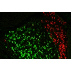 MIT researchers have found that neurons of the anteroventral thalamus (labeled green) play a critical role in spatial working memory. Neurons of the anterodorsal thalamus are labeled in red.
Credits:
Credit: Dheeraj Roy and Ying Zhang